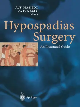 David A. / Hadidi |  Hypospadias Surgery | Buch |  Sack Fachmedien