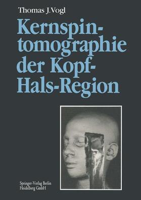 Vogl |  Kernspintomographie der Kopf-Hals-Region | Buch |  Sack Fachmedien
