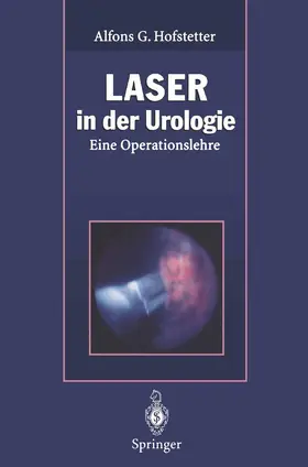 Hofstetter |  Laser in der Urologie | Buch |  Sack Fachmedien