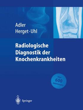 Adler / Uhl / Herget |  Radiologische Diagnostik der Knochenkrankheiten | Buch |  Sack Fachmedien