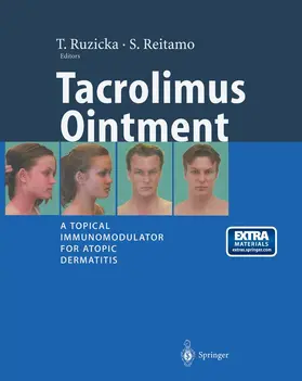 Reitamo / Ruzicka |  Tacrolimus Ointment | Buch |  Sack Fachmedien