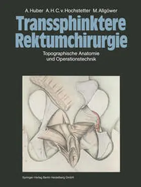 Huber / Allgöwer / Hochstetter |  Transsphinktere Rektumchirurgie | Buch |  Sack Fachmedien