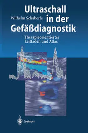 Schäberle |  Ultraschall in der Gefäßdiagnostik | eBook | Sack Fachmedien