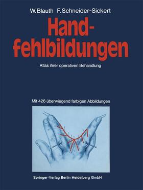 Schneider-Sickert / Blauth |  Handfehlbildungen | Buch |  Sack Fachmedien