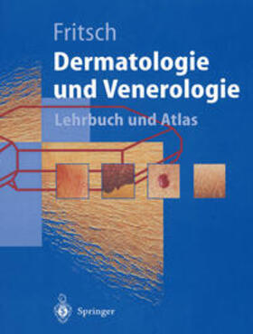 Fritsch |  Dermatologie und Venerologie | eBook | Sack Fachmedien