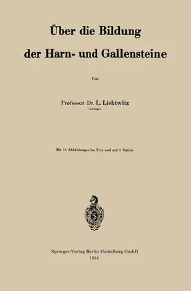 Lichtwitz |  Über die Bildung der Harn- und Gallensteine | Buch |  Sack Fachmedien