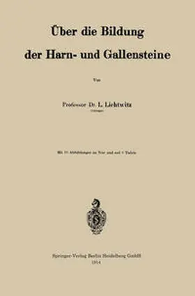 Lichtwitz |  Über die Bildung der Harn- und Gallensteine | eBook | Sack Fachmedien