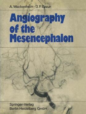 Braun / Wackenheim |  Angiography of the Mesencephalon | Buch |  Sack Fachmedien