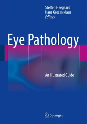 Grossniklaus / Heegaard |  Eye Pathology | Buch |  Sack Fachmedien