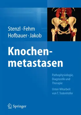 Stenzl / Jakob / Fehm |  Knochenmetastasen | Buch |  Sack Fachmedien