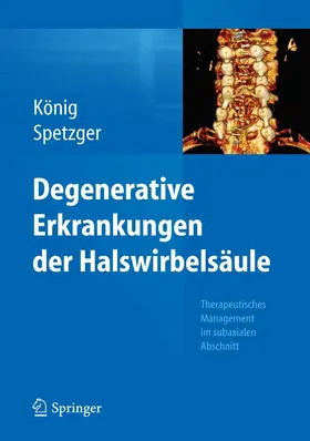 König / Spetzger |  Degenerative Erkrankungen der Halswirbelsäule | eBook | Sack Fachmedien