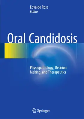 Ribeiro Rosa |  Oral Candidosis | Buch |  Sack Fachmedien