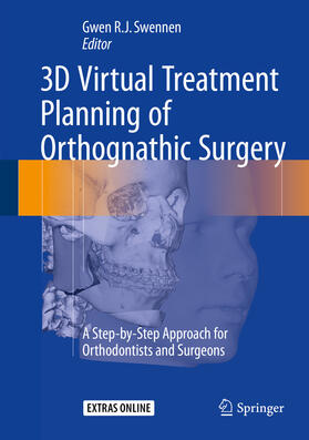 Swennen |  3D Virtual Treatment Planning of Orthognathic Surgery | eBook | Sack Fachmedien