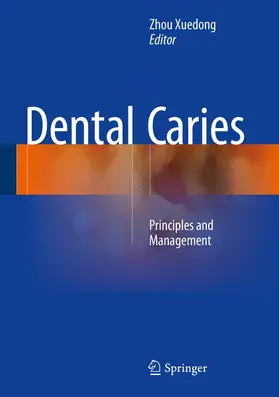 Xuedong |  Dental Caries | Buch |  Sack Fachmedien