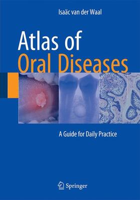 van der Waal |  Atlas of Oral Diseases | Buch |  Sack Fachmedien