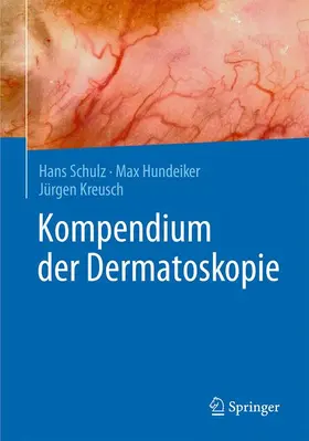 Schulz / Kreusch / Hundeiker |  Kompendium der Dermatoskopie | Buch |  Sack Fachmedien