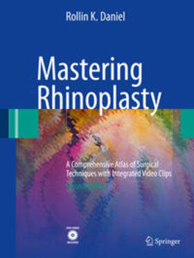 Daniel |  Mastering Rhinoplasty | Buch |  Sack Fachmedien
