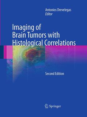 Drevelegas |  Imaging of Brain Tumors with Histological Correlations | Buch |  Sack Fachmedien