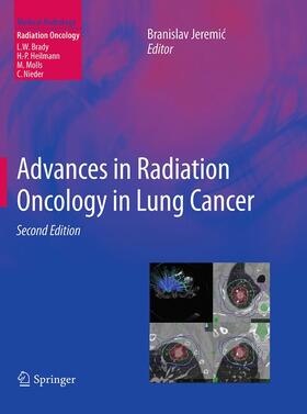 Jeremic |  Advances in Radiation Oncology in Lung Cancer | Buch |  Sack Fachmedien