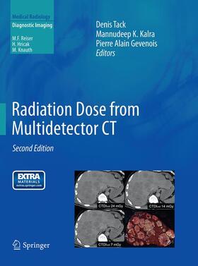 Tack / Gevenois / Kalra |  Radiation Dose from Multidetector CT | Buch |  Sack Fachmedien