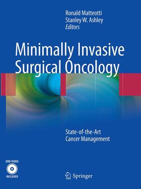 Ashley / Matteotti |  Minimally Invasive Surgical Oncology | Buch |  Sack Fachmedien