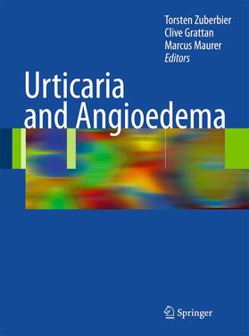 Zuberbier / Maurer / Grattan |  Urticaria and Angioedema | Buch |  Sack Fachmedien