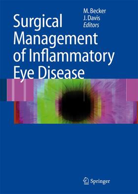 Davis / Becker |  Surgical Management of Inflammatory Eye Disease | Buch |  Sack Fachmedien