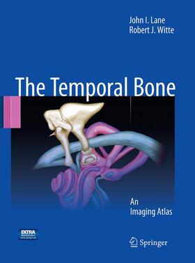 Lane / Witte |  Temporal Bone | Buch |  Sack Fachmedien