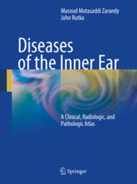 Rutka / Motasaddi Zarandy |  Diseases of the Inner Ear | Buch |  Sack Fachmedien