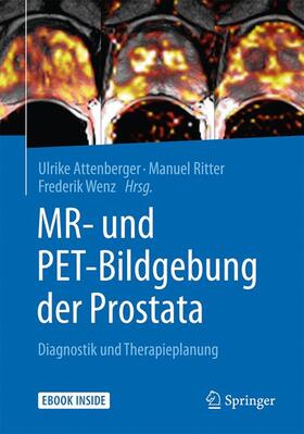 Attenberger / Wenz / Ritter |  MR- und PET-Bildgebung der Prostata | Buch |  Sack Fachmedien