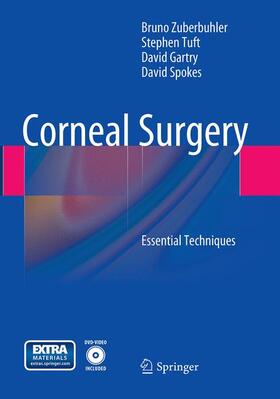 Zuberbuhler / Spokes / Tuft |  Corneal Surgery | Buch |  Sack Fachmedien
