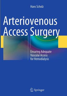 Scholz |  Arteriovenous Access Surgery | Buch |  Sack Fachmedien