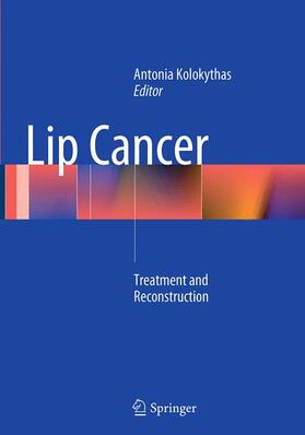 Kolokythas |  Lip Cancer | Buch |  Sack Fachmedien