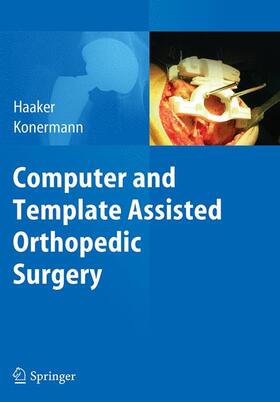 Konermann / Haaker |  Computer and Template Assisted Orthopedic Surgery | Buch |  Sack Fachmedien