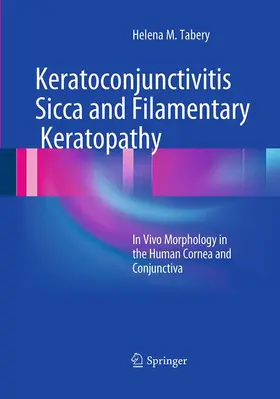 Tabery |  Keratoconjunctivitis Sicca and Filamentary Keratopathy | Buch |  Sack Fachmedien