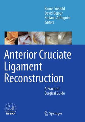Siebold / Zaffagnini / Dejour |  Anterior Cruciate Ligament Reconstruction | Buch |  Sack Fachmedien