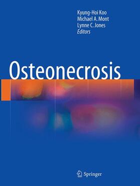 Koo / Jones / Mont |  Osteonecrosis | Buch |  Sack Fachmedien