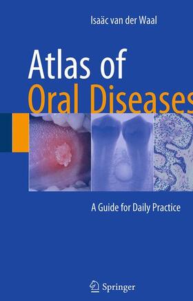 van der Waal |  Atlas of Oral Diseases | Buch |  Sack Fachmedien