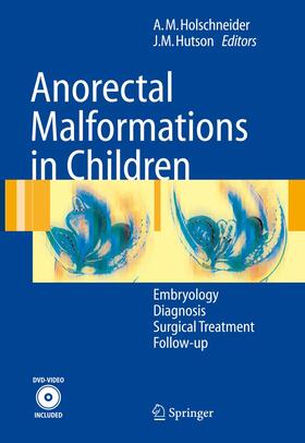 Hutson / Holschneider |  Anorectal Malformations in Children | Buch |  Sack Fachmedien