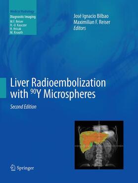 Reiser / Bilbao |  Liver Radioembolization with 90Y Microspheres | Buch |  Sack Fachmedien