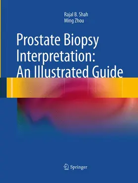 Zhou / Shah |  Prostate Biopsy Interpretation: An Illustrated Guide | Buch |  Sack Fachmedien