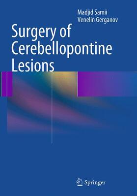 Gerganov / Samii |  Surgery of Cerebellopontine Lesions | Buch |  Sack Fachmedien