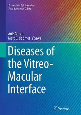 de Smet / Girach |  Diseases of the Vitreo-Macular Interface | Buch |  Sack Fachmedien