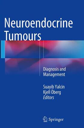 Öberg / Yalcin |  Neuroendocrine Tumours | Buch |  Sack Fachmedien