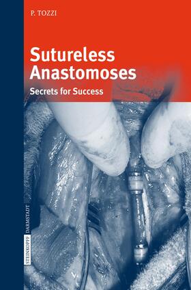 Tozzi |  Sutureless Anastomoses | Buch |  Sack Fachmedien