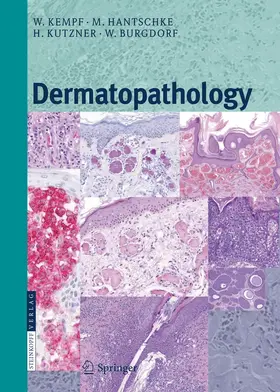 Kempf / Burgdorf / Hantschke |  Dermatopathology | Buch |  Sack Fachmedien