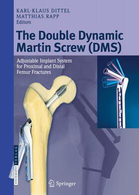 Rapp / Dittel |  The Double Dynamic Martin Screw (DMS) | Buch |  Sack Fachmedien