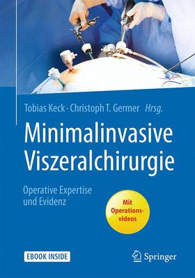 Keck / Germer |  Minimalinvasive Viszeralchirurgie | Buch |  Sack Fachmedien