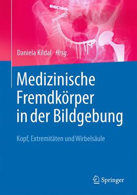 Kildal |  Medizinische Fremdkörper in der Bildgebung | Buch |  Sack Fachmedien