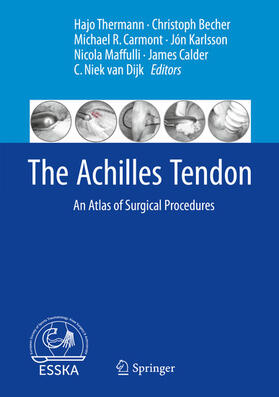 Thermann / Becher / Carmont |  The Achilles Tendon | eBook | Sack Fachmedien